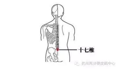 橋弓穴位置|身體的6個應急穴位，高血壓按摩橋弓穴